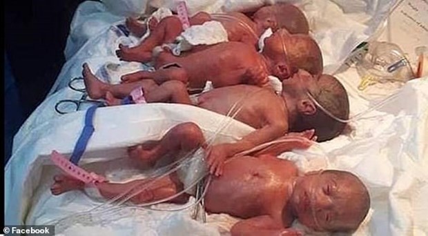Ca sinh 9 hiếm có trên thế giới tại một bệnh viện ở Maroc