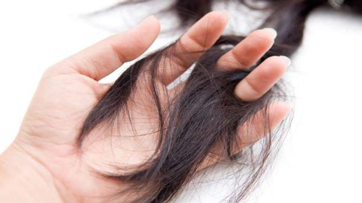 Rụng tóc telogen: Nguyên nhân và cách điều trị
